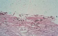 Fig 2. Pigmented spores Fig 2. Pigmented spores