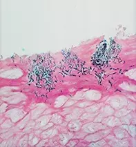 Fig 2. Stratum corneum